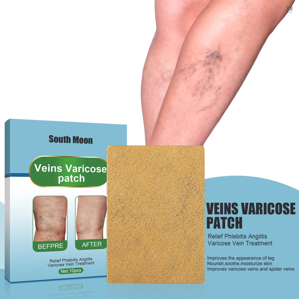 Set 10 Miếng Dán Giảm Giãn Tĩnh Mạch A2Honvn Cải Thiện Bệnh Tĩnh Mạch Chân Cải Thiện Tình Trạng Sưng Chân