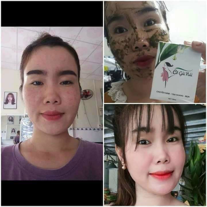 Chính hãng - Kem FACE SỮA 5in1 CÔ GÁI NÚI dưỡng trắng , giảm mụn , mờ thâm nám