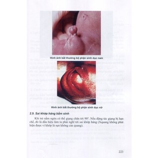 Sách - Thủ thuật sản khoa