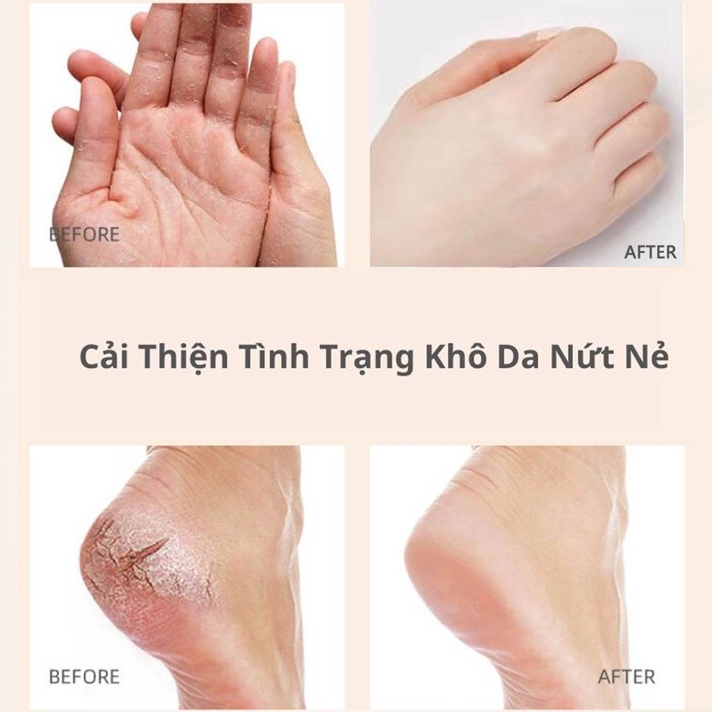 Kem chống nứt nẻ gót chân MEIDIAN phục hồi da tay da chân 15g mỹ phẩm nội địa trung chính hãng