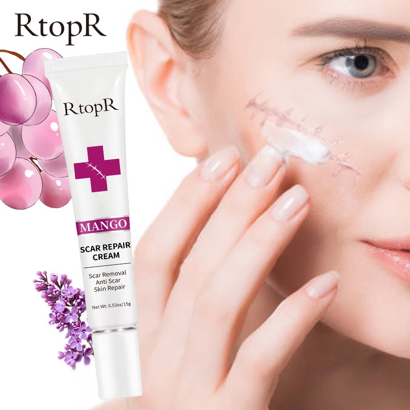 Kem xóa sẹo RtopR mango scar repair cream 15g Xóa và sửa sẹo trên mặt， cơ thể, vết bỏng ở trẻ em,  phụ nữ sau sinh mổ