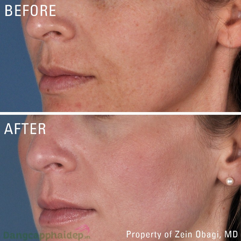 Kem chống lão hóa da ban đêm Z0 Radical Night Repair date 3.24