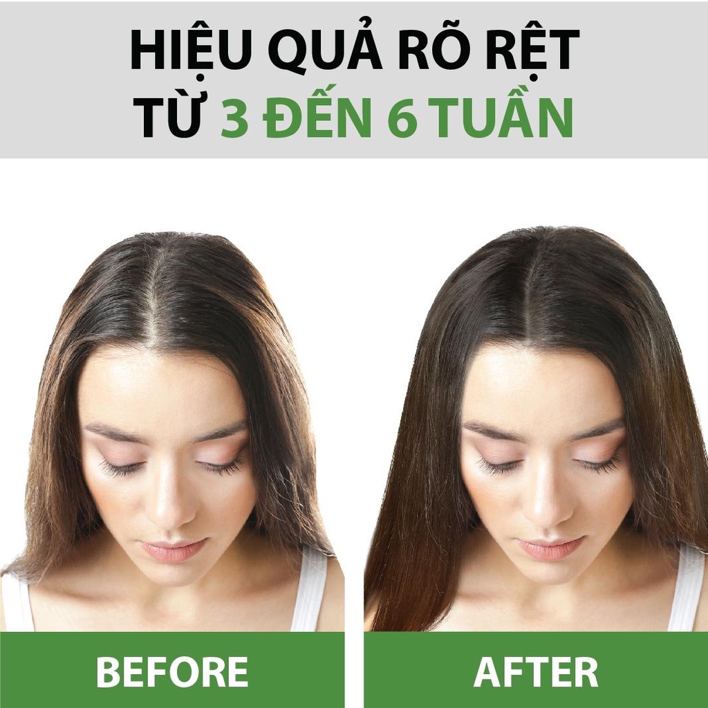 Combo 2 Serum Bưởi Ngừa Rụng &amp; Kích Thích Mọc Tóc Từ Tinh Dầu Bưởi Nguyên Chất MILAGANICS 100ml (Chai)