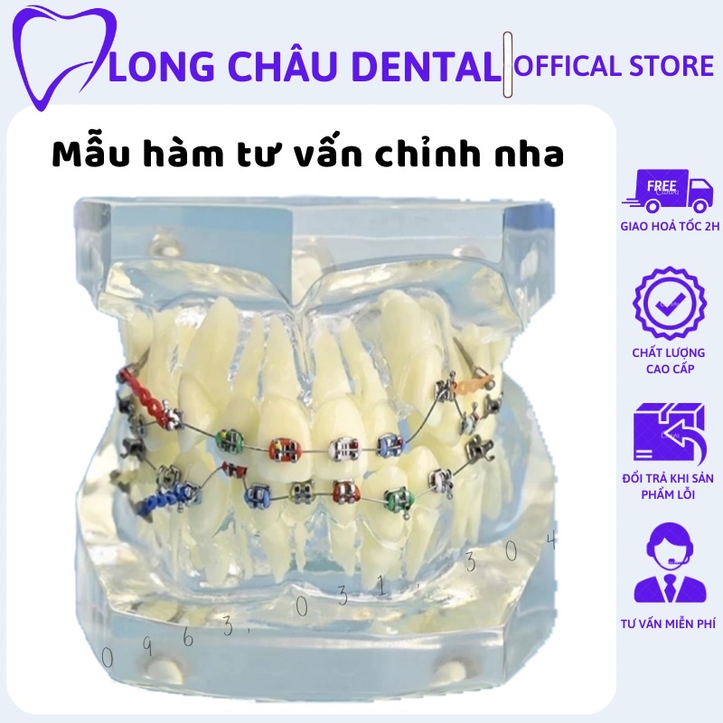 Mẫu hàm tư vấn chỉnh nha khí cụ