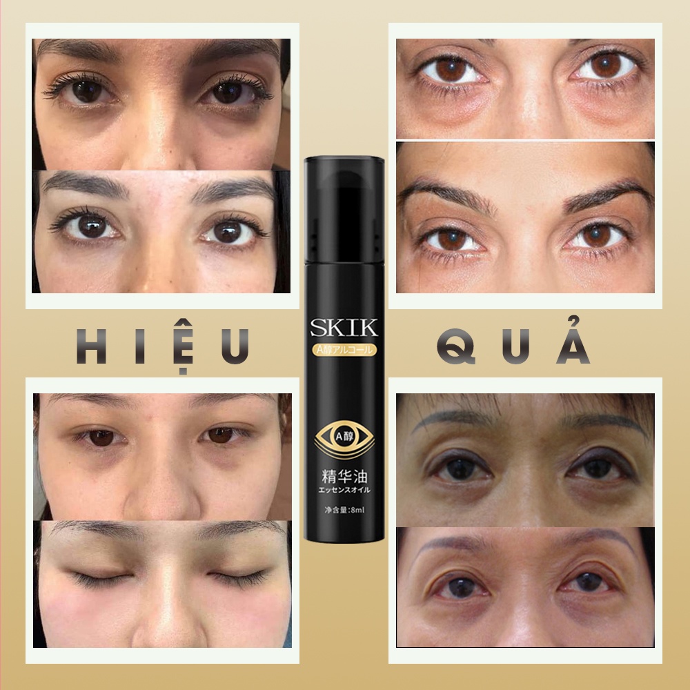 Thanh lăn bọng mắt SKIK - Thanh lăn SKIK hỗ trợ giảm quầng thâm mắt, tan bọng mắt, làm mờ nếp nhăn quanh mắt