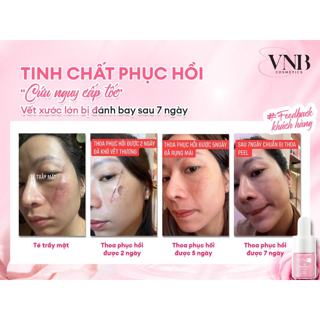 Tinh Chất Phục Hồi VNB Magical Recover Ampoule - Phục Hồi Da Sau Treatment Dưỡng Da Sáng Hồng Tự Nhiên | BigBuy360 - bigbuy360.vn