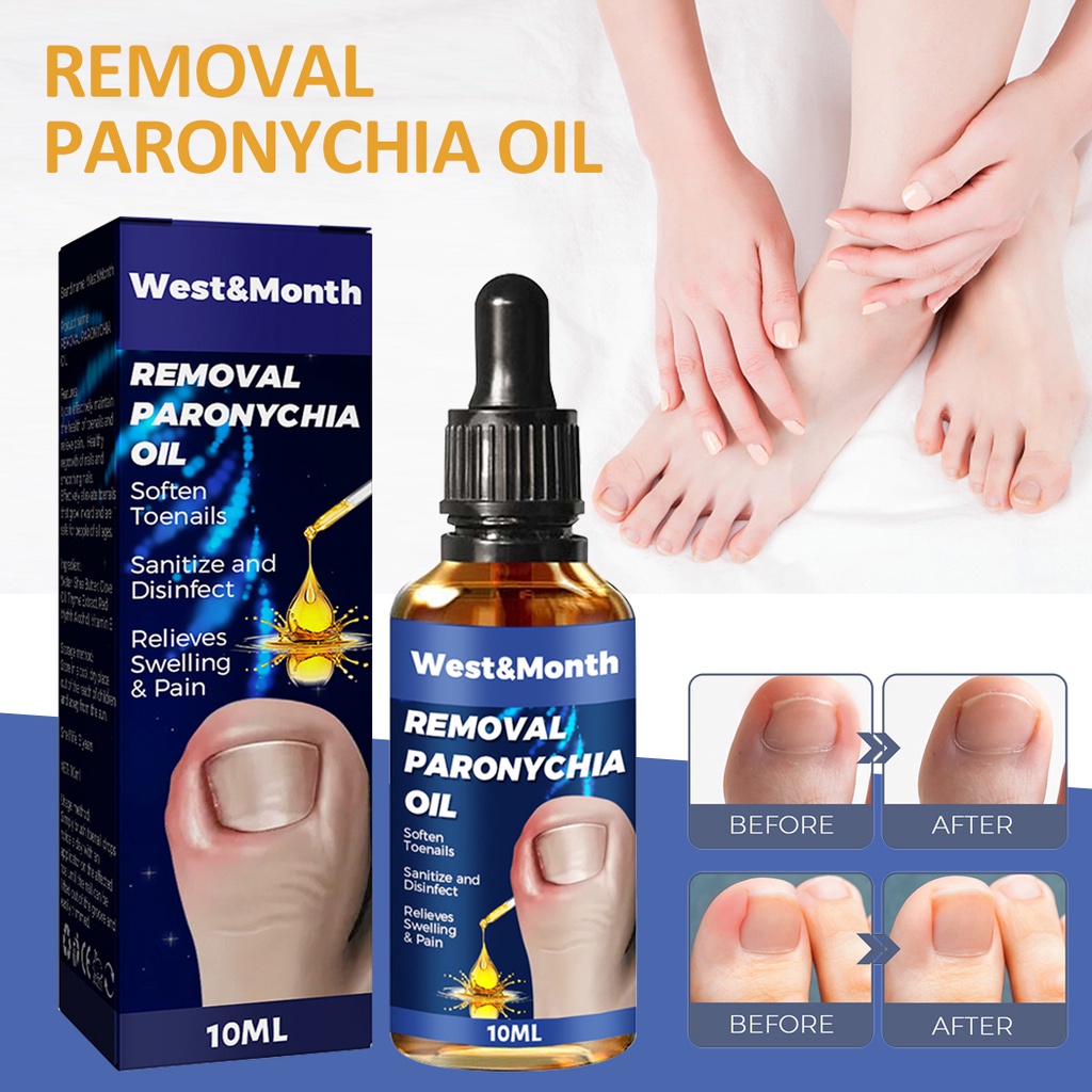 Tinh Dầu Paronychia 10ml Hỗ Trợ Giảm Bệnh Nấm Móng Chân
