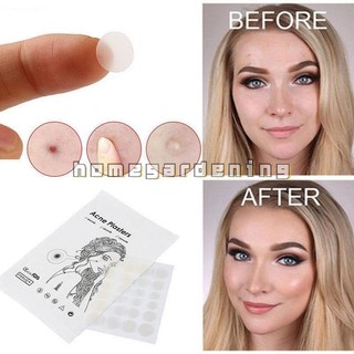 Set 36 Miếng Dán Mụn Hydrocolloid Vô Hình Chăm Sóc Da