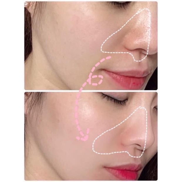 Mặt Nạ Ủ Trắng Da Và Tẩy Tế Bào Chết HERBAL PEEL TOX 120ml