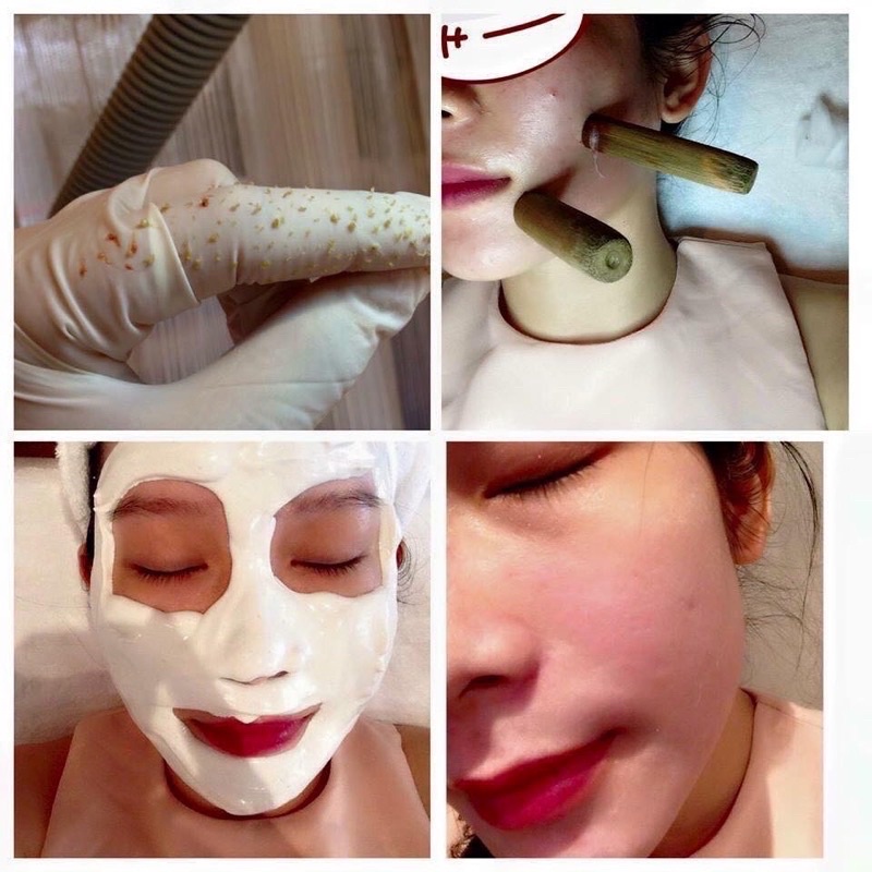 Mặt nạ thạch cao, Mặt nạ cứng giảm sưng sau nặn mụn.Chuyên dùng cho Spa