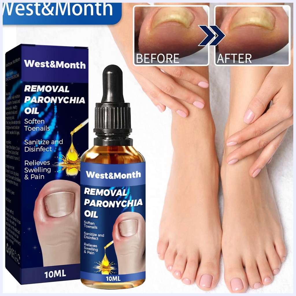 Tinh Chất Dưỡng Móng Chân 10ml Hiệu Quả