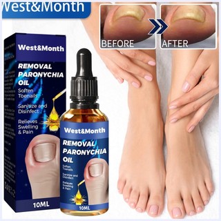 Tinh Chất Dưỡng Móng Chân 10ml Hiệu Quả