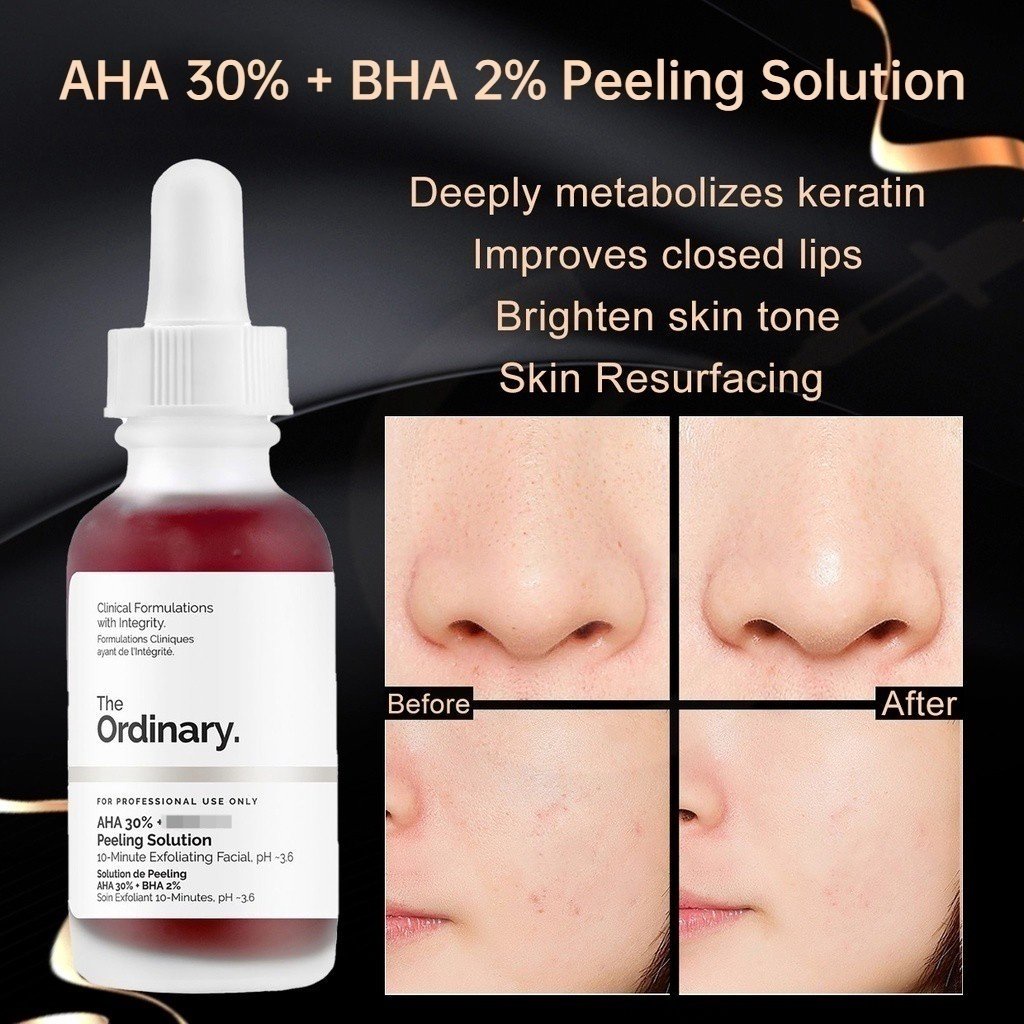 THE ORDINARY Hàng Có Sẵn Axit Salicylic 30% AH-A + B-HA 2% Chính Hãng Tinh Chất Tẩy Tế Bào Chết Toàn Thân 30ML
