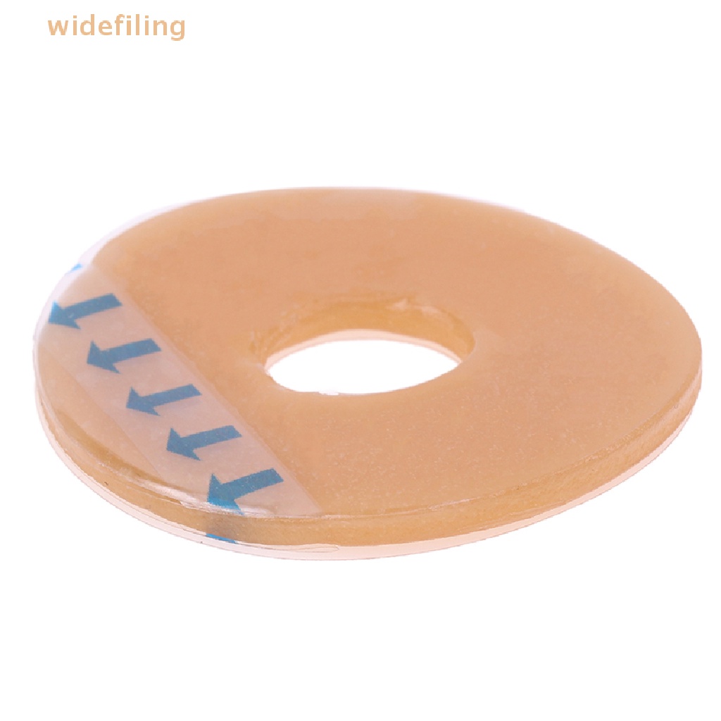 1 Nhẫn Dán Chăm Sóc Sức Khỏe Chống Rò Rỉ Dành Cho Túi Ostomy