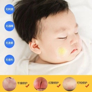 Kem dưỡng trẻ em Nobif Kem kháng khuẩn chính hãng Kem dưỡng Mông đỏ Thuốc mỡ bảo vệ mông Kem chống muỗi Kem cắn
