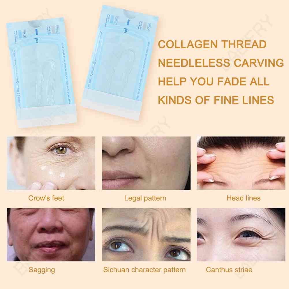 Túi 12 Cuộn Chỉ Collagen Nâng Cơ Mặt Tiện Dụng