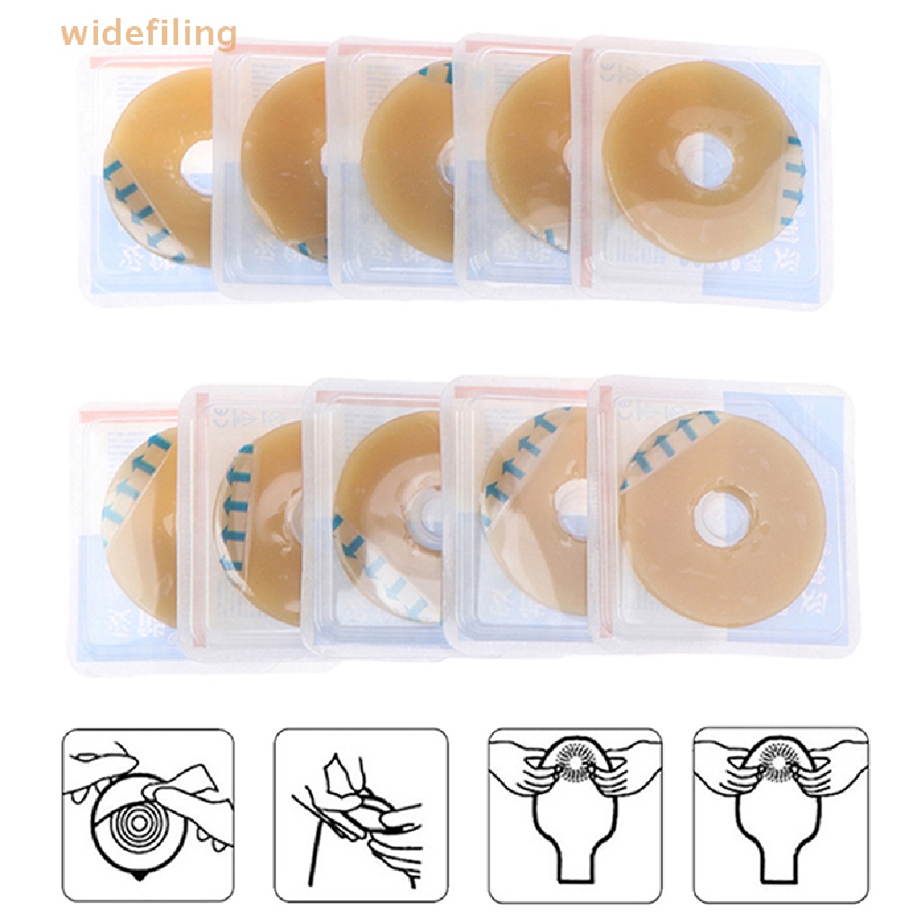 1 Nhẫn Dán Chăm Sóc Sức Khỏe Chống Rò Rỉ Dành Cho Túi Ostomy