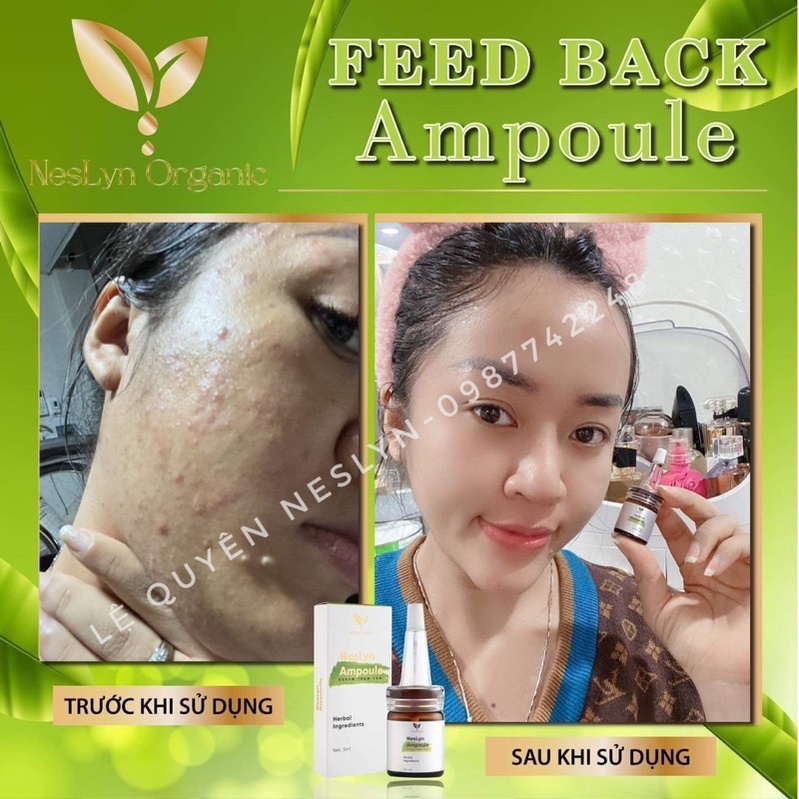 Serum gom cồi mụn, ngừa thâm Neslyn Ampoule chính hãng