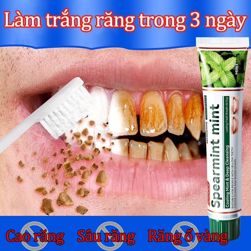 KEM ĐÁNH RĂNG làm trắng loại bỏ cao răng màu vàng làm trắng răng thở trong lành để thoát khỏi hơi thở hôi loại bỏ vết ố răng