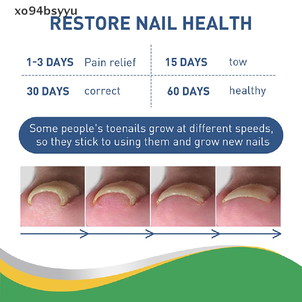 Set 50 Miếng Dán Chỉnh Sửa Móng Chân Xo94Bsyu Tiện Dụng