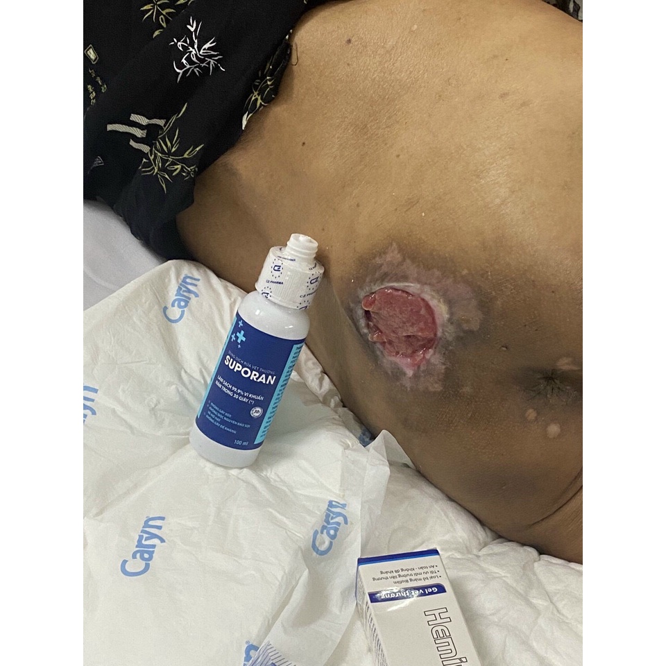 SUPORAN - Dung dịch sát khuẩn làm sạch 99,9% vi khuẩn, nấm trong vòng 30 giây chai 100ml