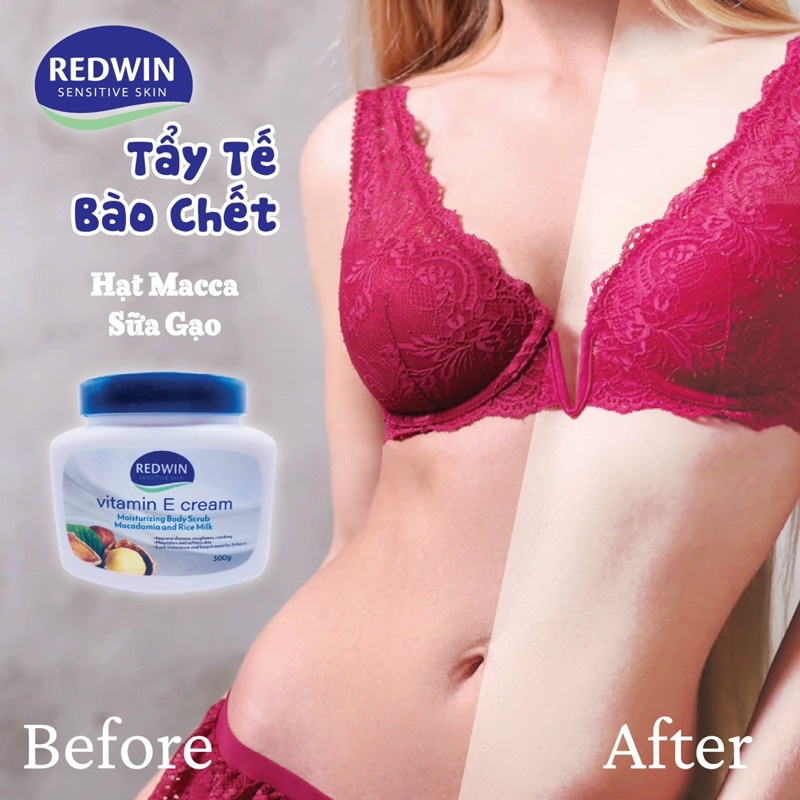 KEM TẨY TẾ BÀO CHẾT & DƯỠNG DA MỀM MỊN Redwin Vitamin E Cream Úc