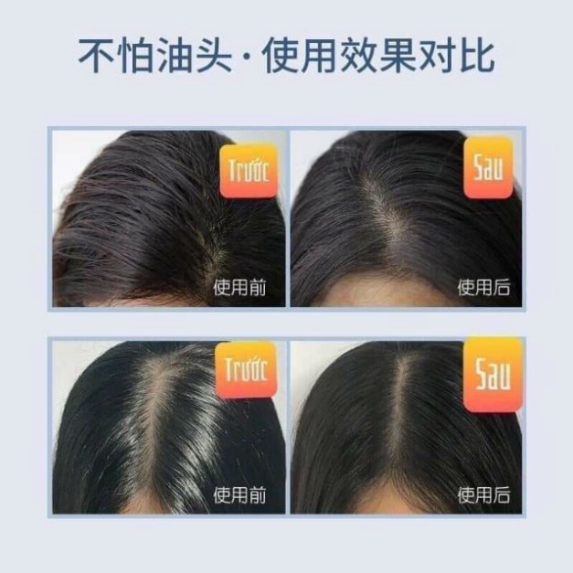 Dầu Gội Khô Issy 150ml Dạng Xịt An Toàn Không Cần Nước Dùng Cho Nam, Nữ Không Bết Tóc Gx28