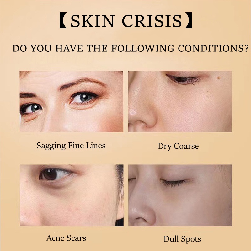 Mặt Nạ Trứng Sammi SRZSI Làm Trắng Hydrat Hóa Làm Mờ Vết Thâm