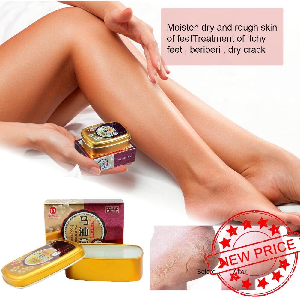 Kem Dầu Ngựa Trị Nứt Nẻ Da Tay Chân Chống Đóng Băng R2K4