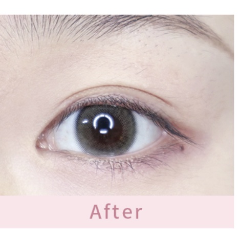 Kích Mí Miếng Dạng Lưới Chưa có keo - 120 miếng kích mí