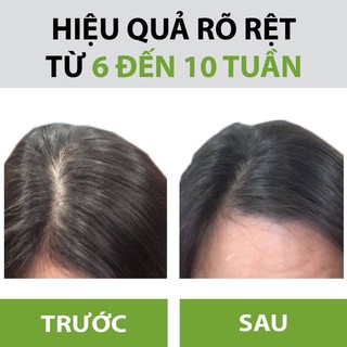 Xịt Dưỡng Tóc Hoa Đà
