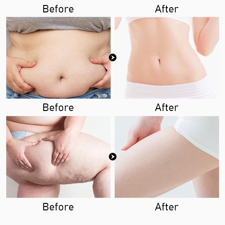 Tinh dầu massage giảm béo MOOYAM slimming essential oil 30ml Tập thể dục, đốt mỡ, giảm cân, tạo hình