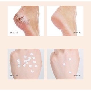 Kem Dưỡng Da Chân Chống Nứt Nẻ Và Nứt Nẻ Hiệu Quả