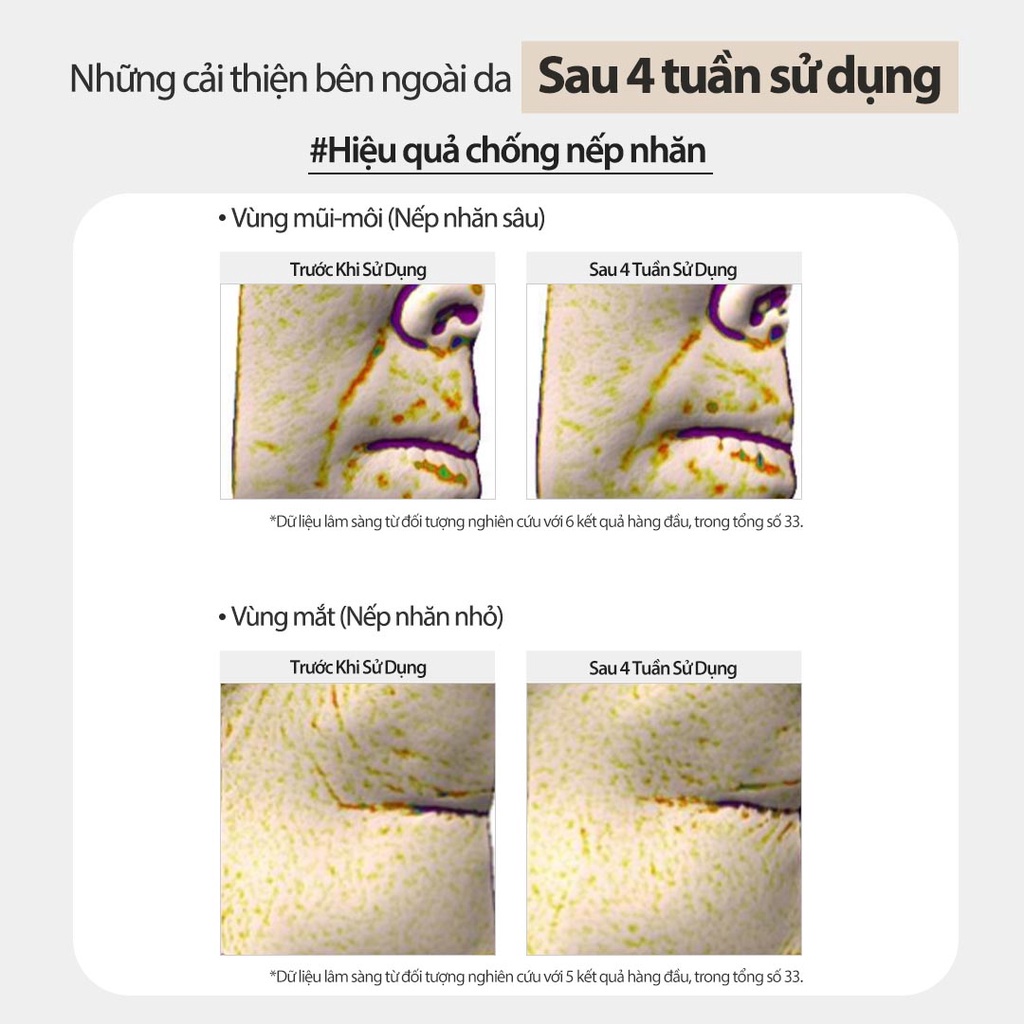 Kem dưỡng chống lão hóa Laneige Perfect Renew 3X Cream 8ml Phiên bản cải tiến