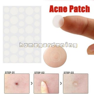 Set 36 Miếng Dán Mụn Hydrocolloid Vô Hình Chăm Sóc Da