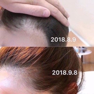 Mọc tóc thảo dược Sato - Nhật bản