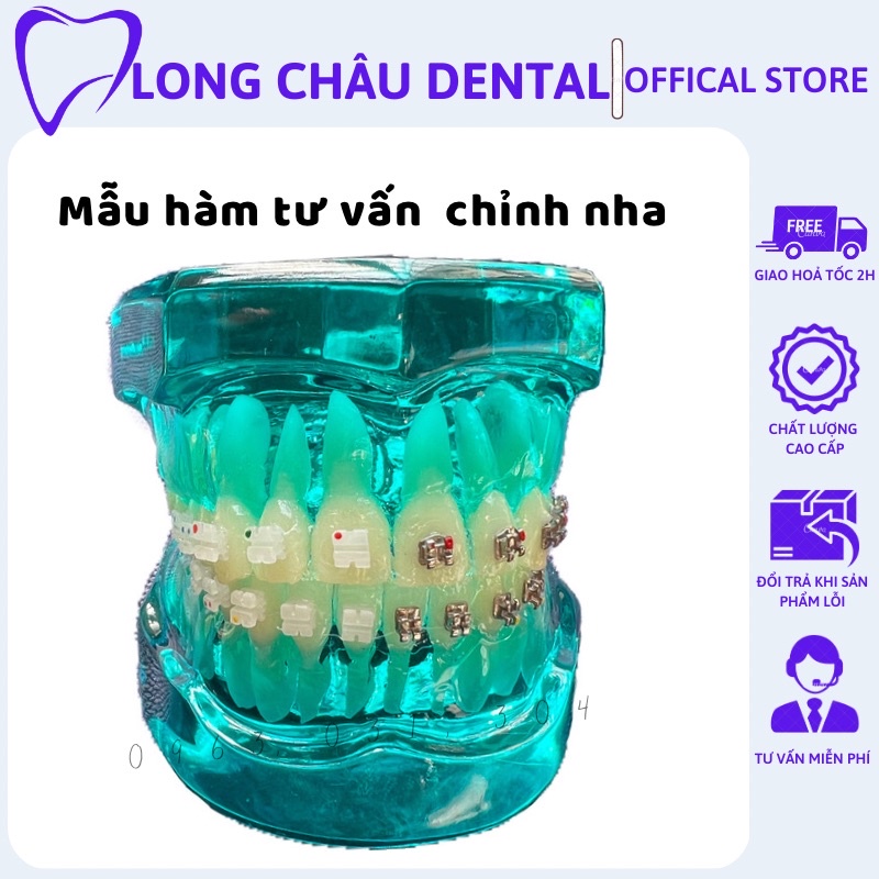Mẫu hàm tư vấn chỉnh nha Mẫu hàm tư vấn mắc cài