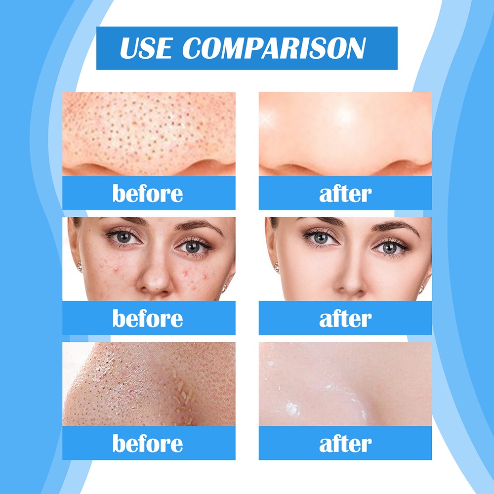 Sữa Rửa Mặt Tinh Chất Oligopeptide Làm Sạch Sâu Thu Nhỏ Lỗ Chân Lông