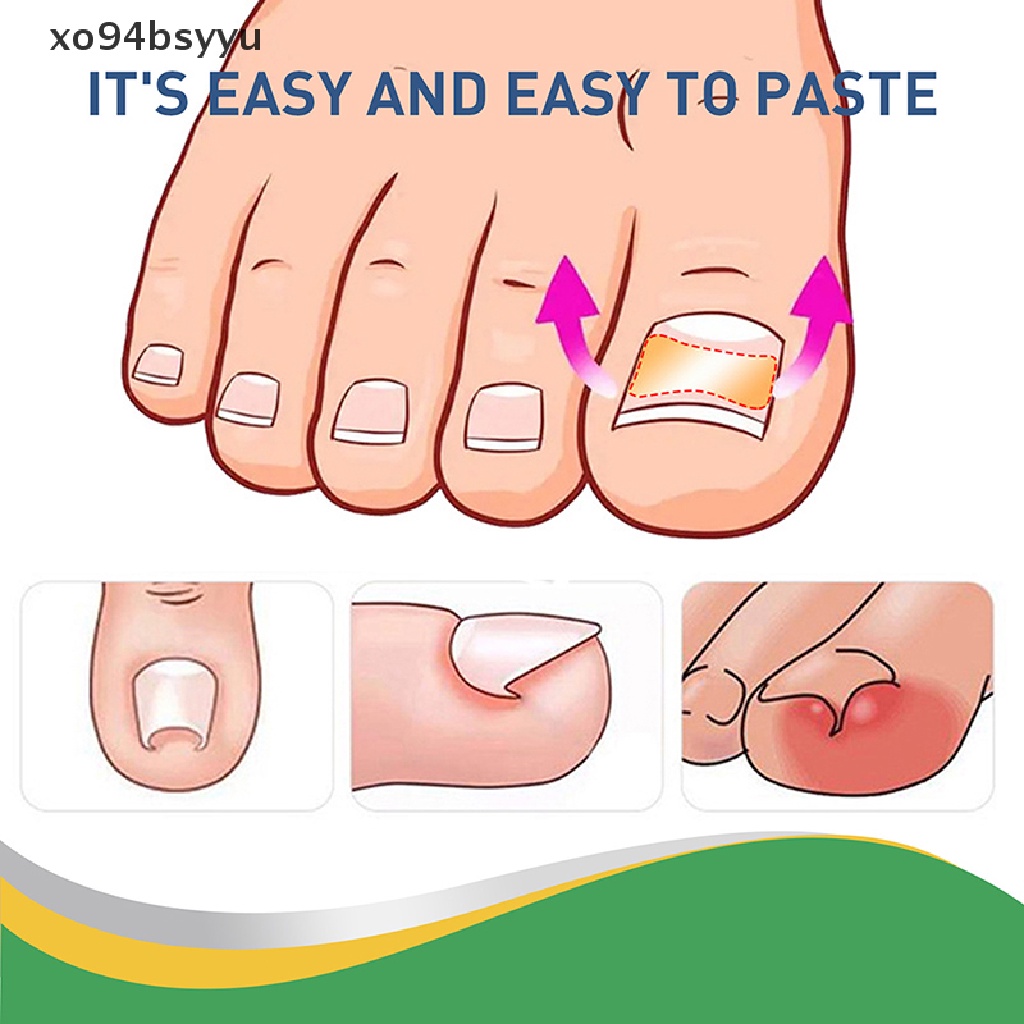 Set 50 Miếng Dán Chỉnh Sửa Móng Chân Xo94Bsyu Tiện Dụng