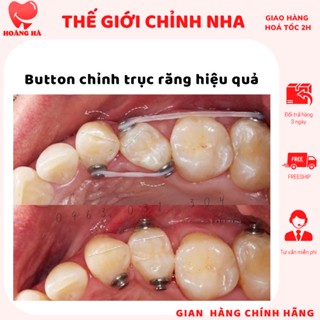 Set 10 cái Button chỉnh trục răng Button chỉnh nha núm tròn chỉnh nha