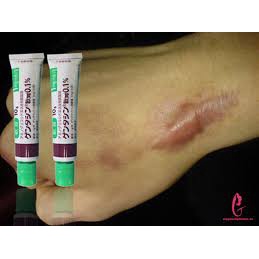 Kem mờ sẹo lồi sẹo mổ đẻ sau sinh kem mờ sẹo Gentacin Nhật shopbanhgaobaby