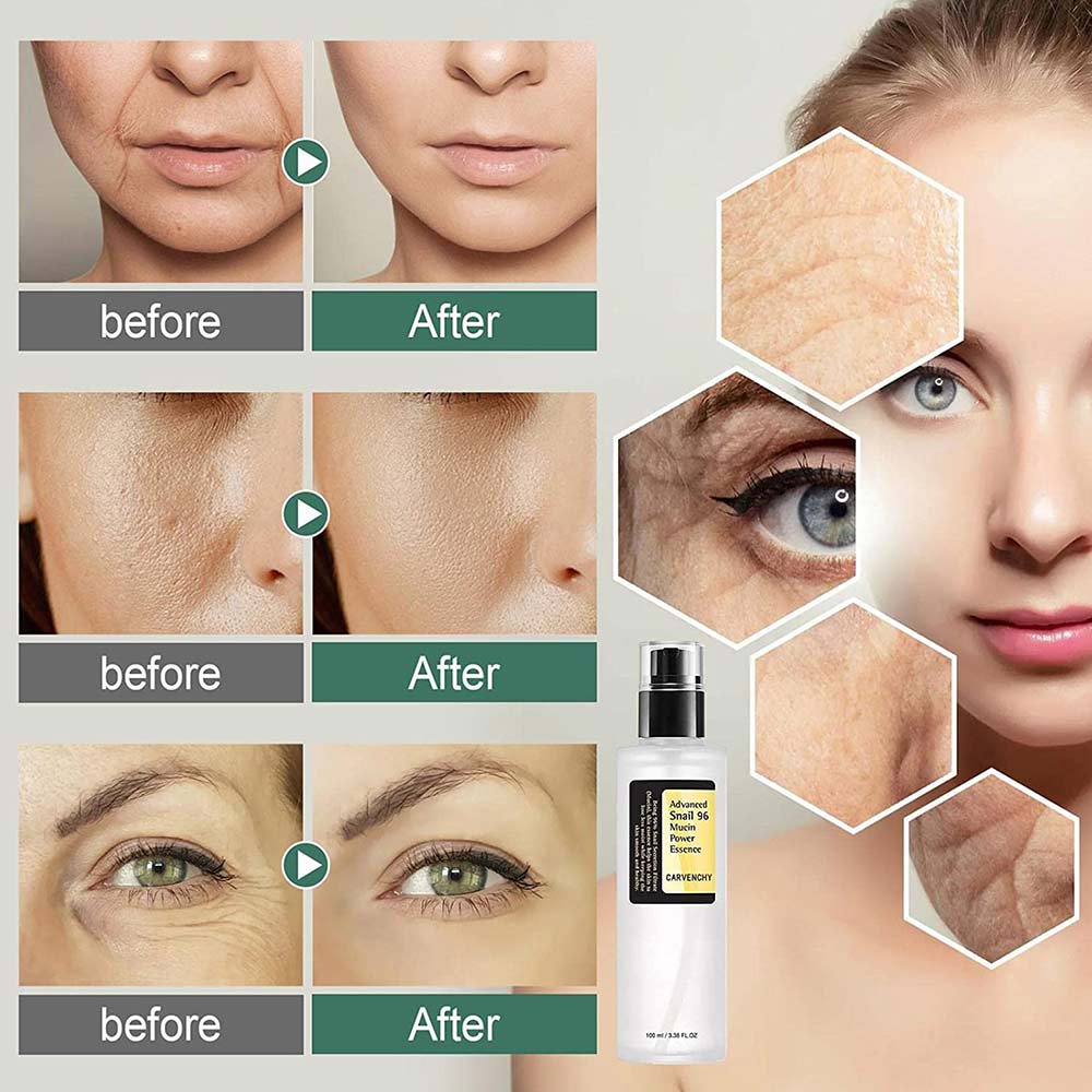 Advanced Snail 96 Mucin Power Essence 100ml, Snail Secretion Filtrate 96.3%, for Anti-aging & Nourishing, Wrinkle Improvement