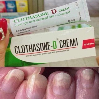 Kem bôi Nấm móng tay móng chân Clothasone d cream Nội địa thái lan hangthailan263 hangthailan263