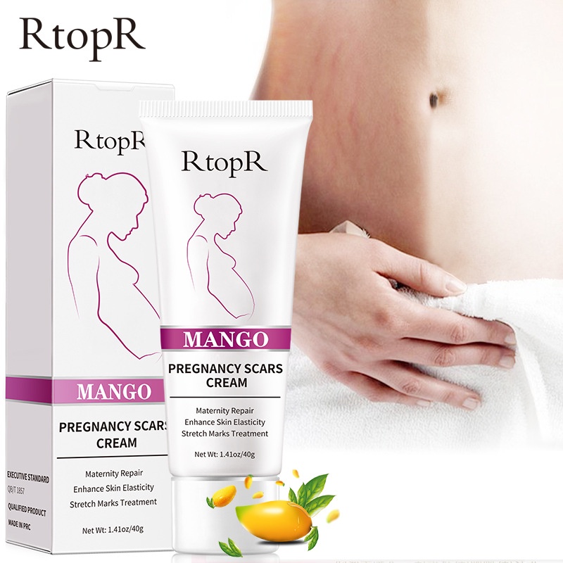 【💯Hàng thật】Kem dưỡng trị rạn da RtopR mango pregnancy scars cream 40g Dự phòng cho phụ nữ có thai, khắc phục rạn da