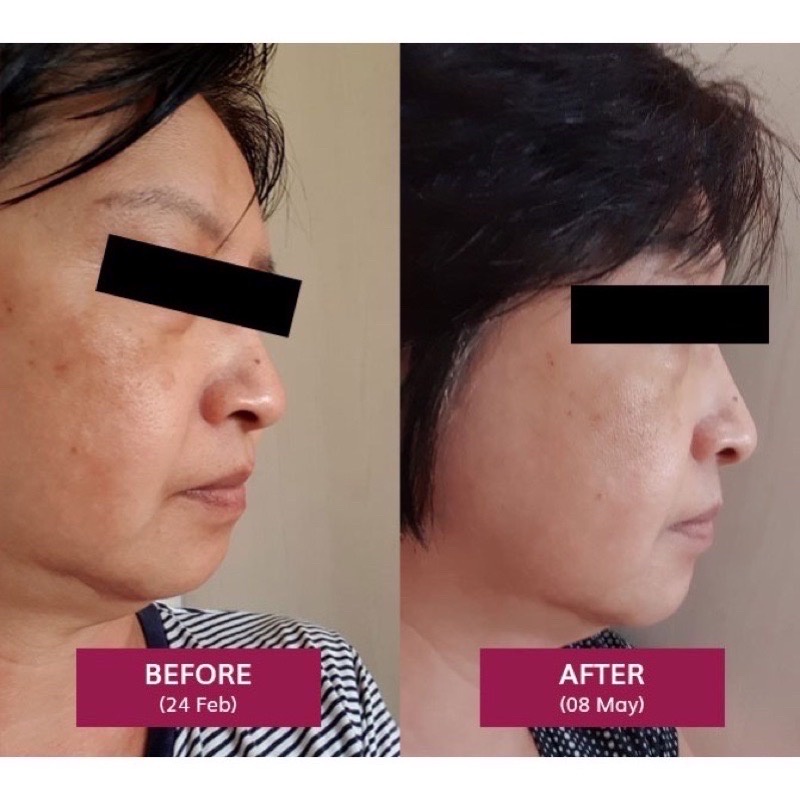 Mẫu mới Fairence T- Complex  Kem làm giảm Nám Da, Tàn Nhang, Đốm Nâu, Giúp Sáng Da Tdf Fairence chính hãng