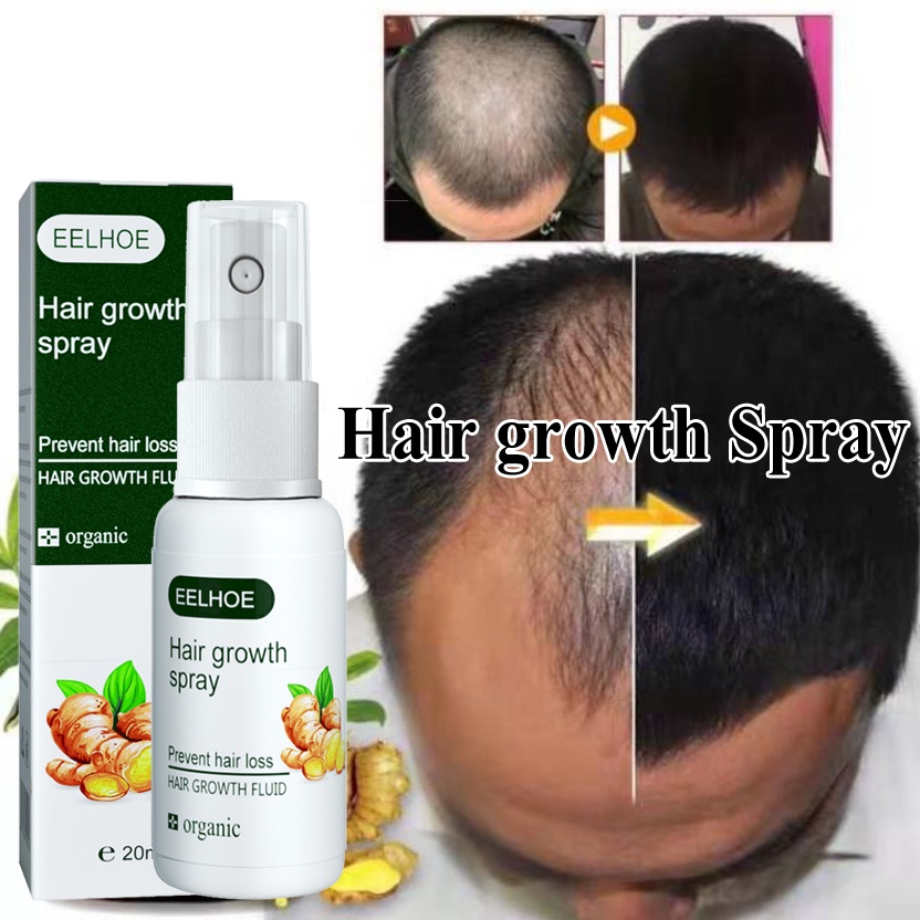 EELHOE serum mọc tóc kích mọc tóc kích thích mọc tóc 20ML Tinh chất mọc tóc tinh dầu mọc tóc thuốc kích thích mọc tóc ngăn ngừa rụng tóc phục hồi tóc hư