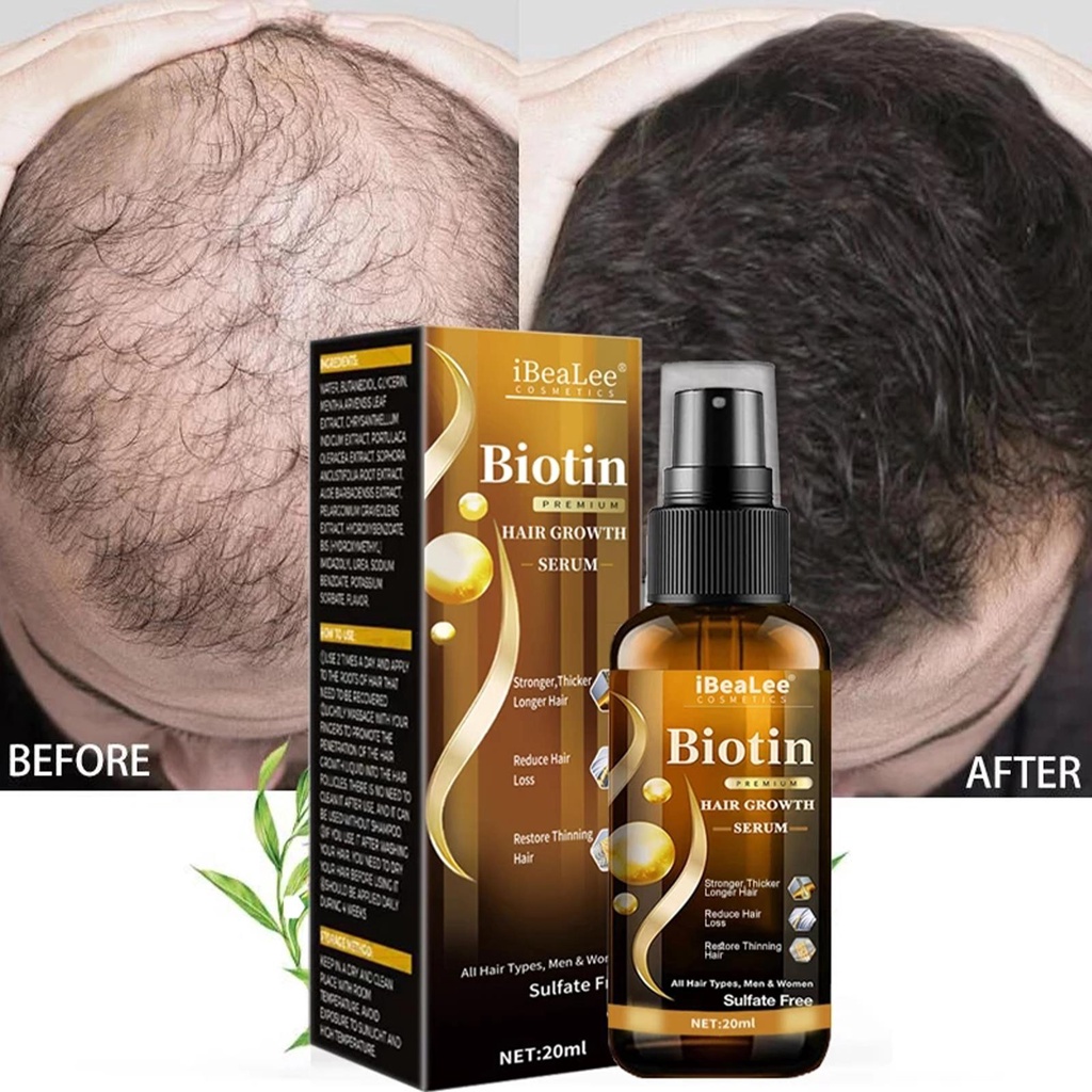 Biotin Tinh Dầu Kích Thích Mọc Tóc Nhanh Chóng Cho Nam Và Nữ