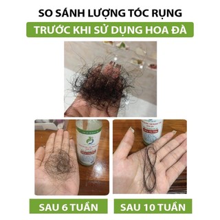 Xịt Dưỡng Tóc Hoa Đà