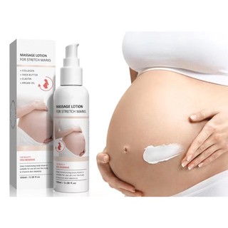 Kem Vết rạn da QEM 100ml Dự phòng cho phụ nữ có thai, khắc phục rạn da