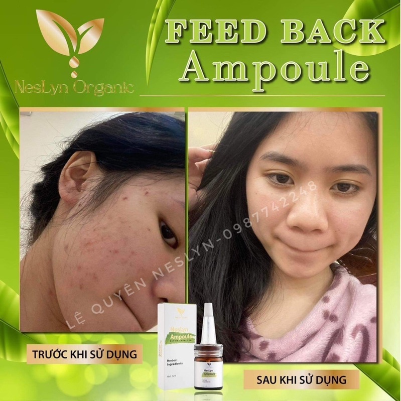 Serum gom cồi mụn, ngừa thâm Neslyn Ampoule chính hãng